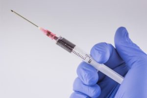 注入によるたるみ治療「PRP療法」