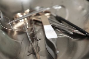 糸によるたるみ治療「スレッドリフト」