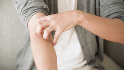 Young,Man,Is,Scratching,His,Arm