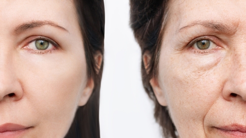 Comparison,Of,The,Face,Of,Young,And,Aged,Women.,Youth,