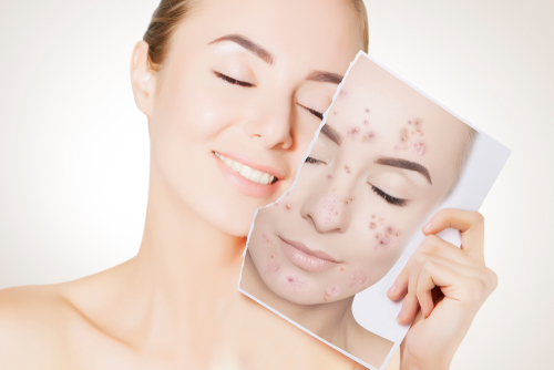 Closeup,Portrait,Of,Woman,With,Clean,Skin,Holding,Portrait,With