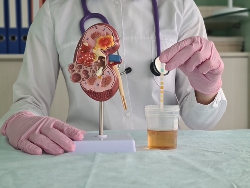 Medical,Scientist,Conducts,Ph,Test,With,Urine,Sample.,Doctor,Urinalysis
