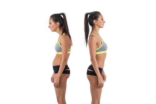 Woman,With,Impaired,Posture,Position,Defect,Scoliosis,And,Ideal,Bearing